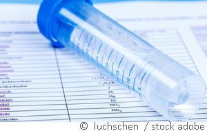 wasseranalyse